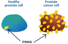 Healthy prostate cell vs prostate cancer cell Healthy prostate cell vs prostate cancer cell
